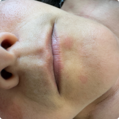 antes boca antes boca