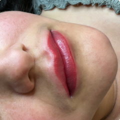 depois boca depois boca