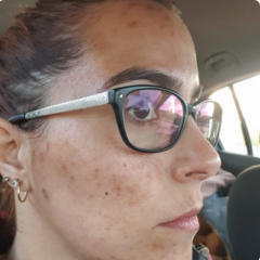 antes rosto antes rosto