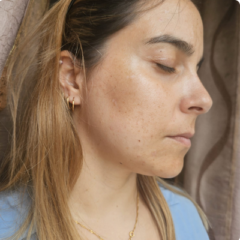 depois rosto depois rosto